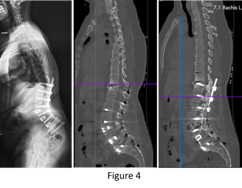 figure4